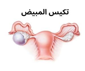 أسباب المغص أسفل البطن عند النساء