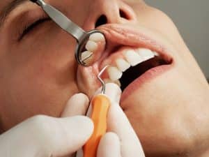 علاج التهاب الاسنان واللثة